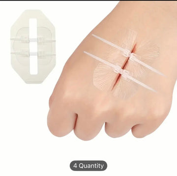 Quick-Zip Pressure Relief Closure Plasters (Packet of 8 buckles) Prepper Alert!