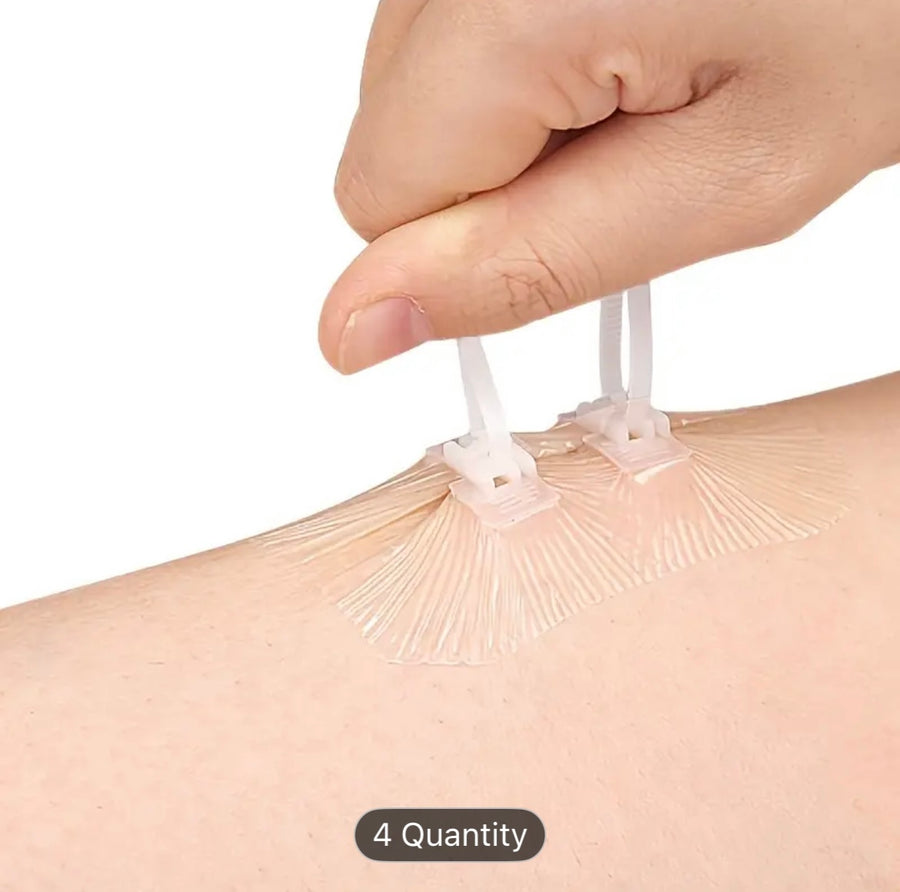Quick-Zip Pressure Relief Closure Plasters (Packet of 8 buckles) Prepper Alert!