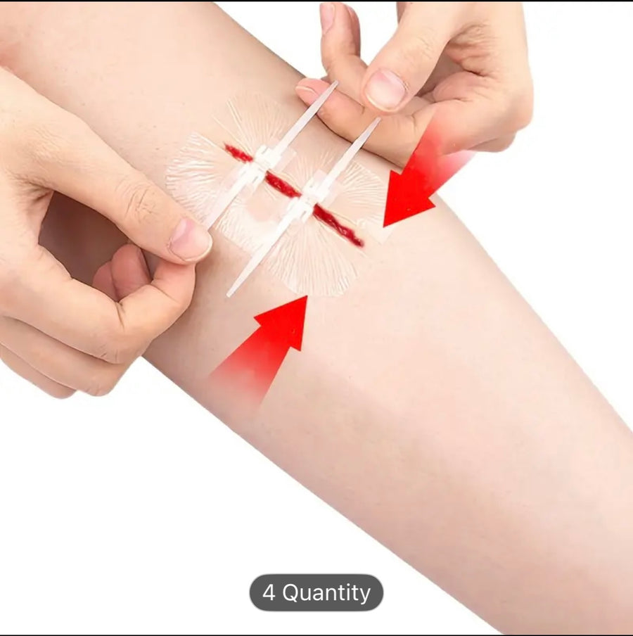 Quick-Zip Pressure Relief Closure Plasters (Packet of 8 buckles) Prepper Alert!